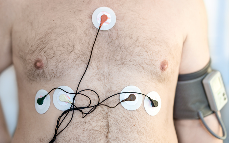 Ambulatory BP Monitoring - Galaxy Hospital & Critical Care Centre